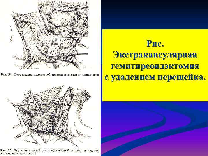 Рассмотрите рисунок на странице 148 что доказывает опыт с удалением эндосперма