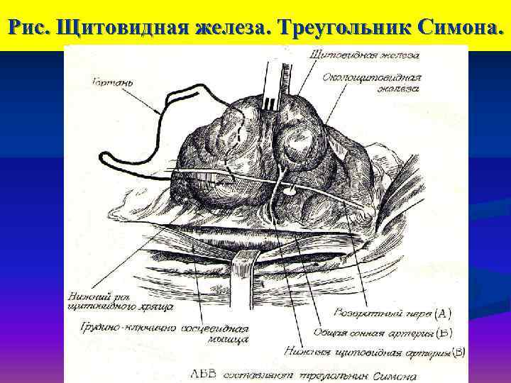 Кровоснабжение щитовидной железы схема