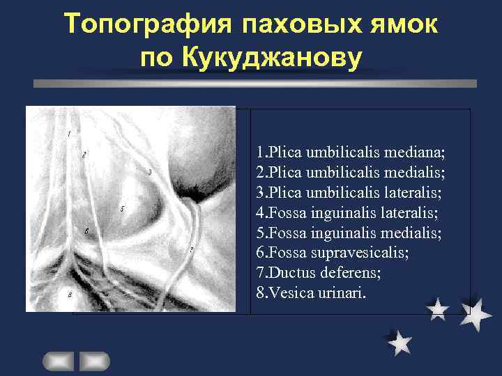 Топография паховых ямок по Кукуджанову    1. Plica umbilicalis mediana;  