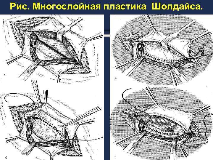 Факультетская хирургия в схемах и таблицах