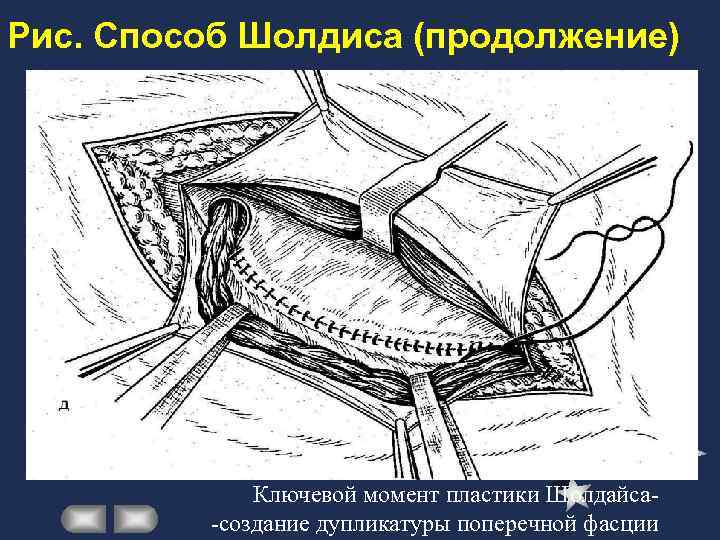 Курс факультетской хирургии в рисунках таблицах и схемах