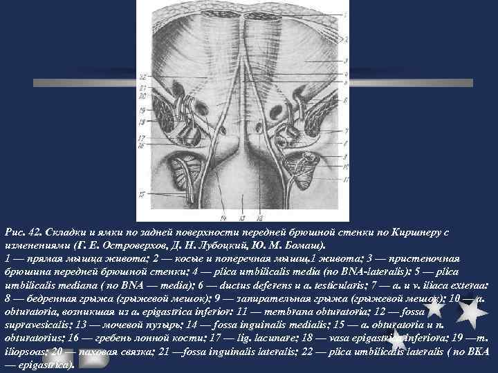 Доступы через переднюю брюшную стенку схема