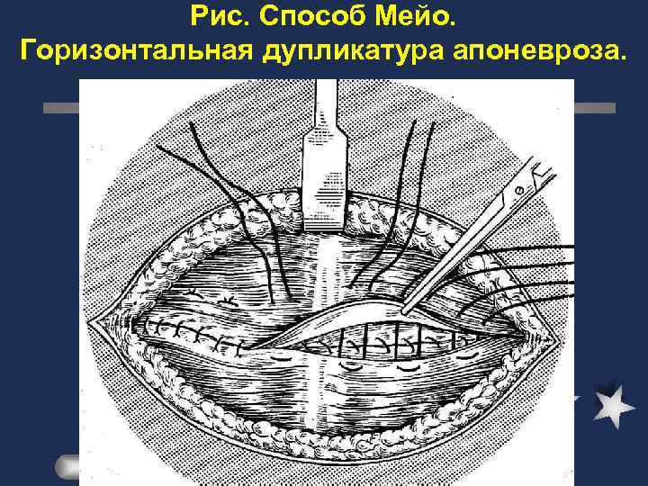 Мост мейо и остров бель карта