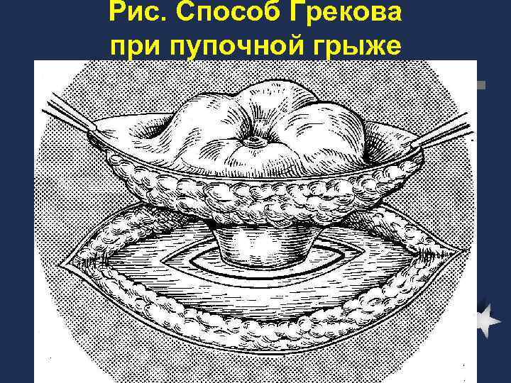 Рис способ