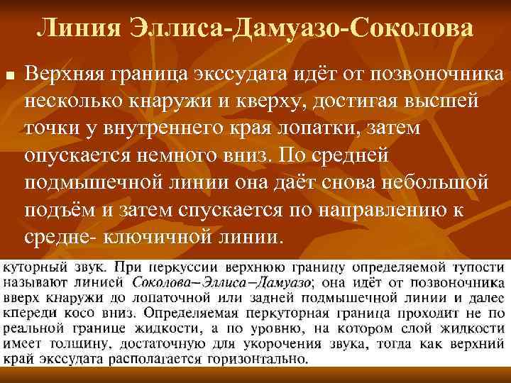  Линия Эллиса-Дамуазо-Соколова n  Верхняя граница экссудата идёт от позвоночника несколько кнаружи и
