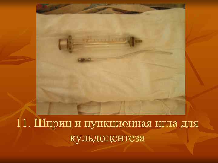 11. Шприц и пункционная игла для   кульдоцентеза 