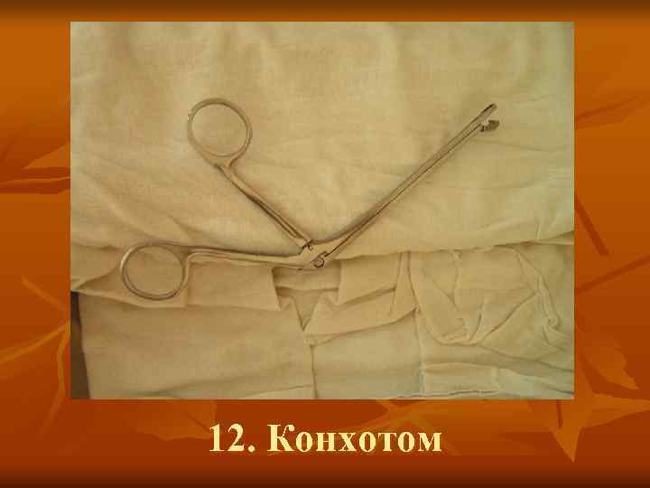 12. Конхотом 