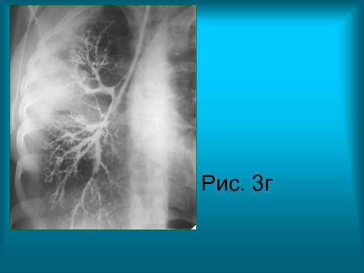 Рис. 3 г Рис. 3 г