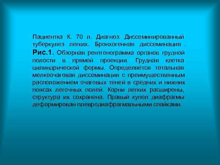 Пациентка К. 70 л. Диагноз: Диссеминированный туберкулез легких. Бронхогенная диссеминация. Рис. 1. Обзорная рентгенограмма Пациентка К. 70 л. Диагноз: Диссеминированный туберкулез легких. Бронхогенная диссеминация. Рис. 1. Обзорная рентгенограмма