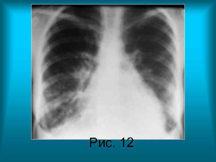 Рис. 12 Рис. 12