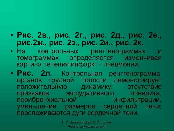  • Рис. 2 в. , рис. 2 г. , рис. 2 д. ,