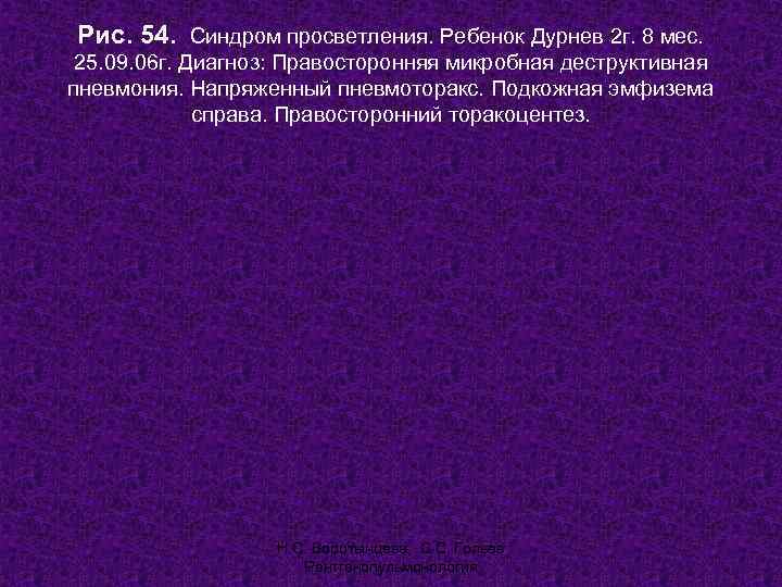 Рис. 54. Синдром просветления. Ребенок Дурнев 2 г. 8 мес.  25. 09. 06