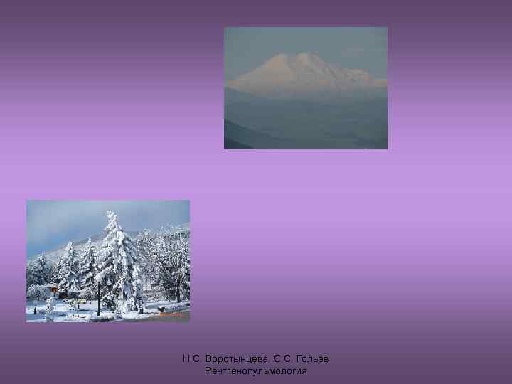 Н. С. Воротынцева. С. С. Гольев Рентгенопульмология 