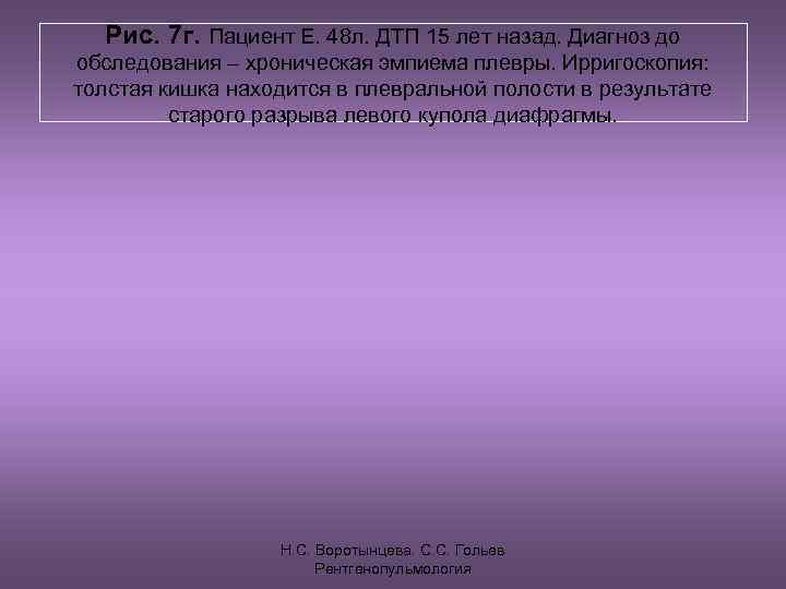  Рис. 7 г. Пациент Е. 48 л. ДТП 15 лет назад. Диагноз до