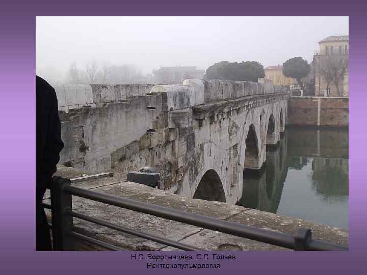 Н. С. Воротынцева. С. С. Гольев Рентгенопульмология 