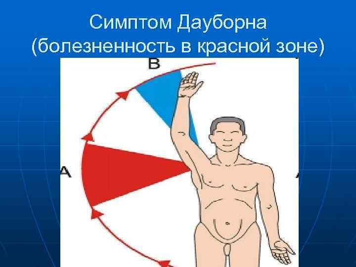  Симптом Дауборна (болезненность в красной зоне) 