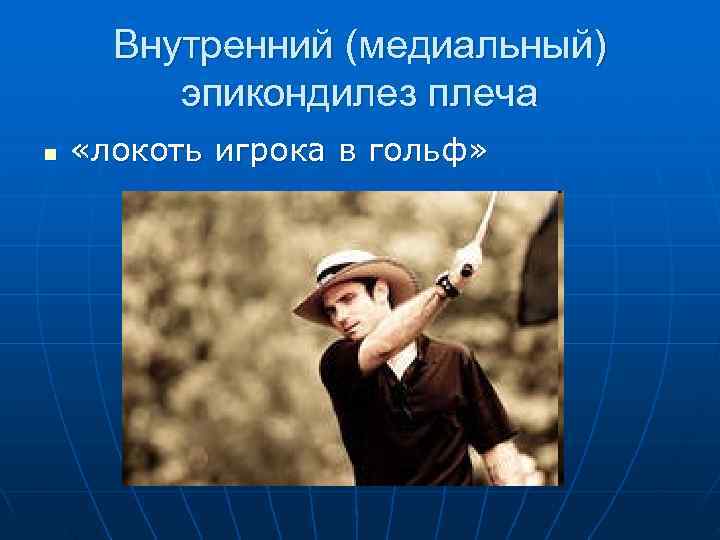  Внутренний (медиальный)   эпикондилез плеча n  «локоть игрока в гольф» 