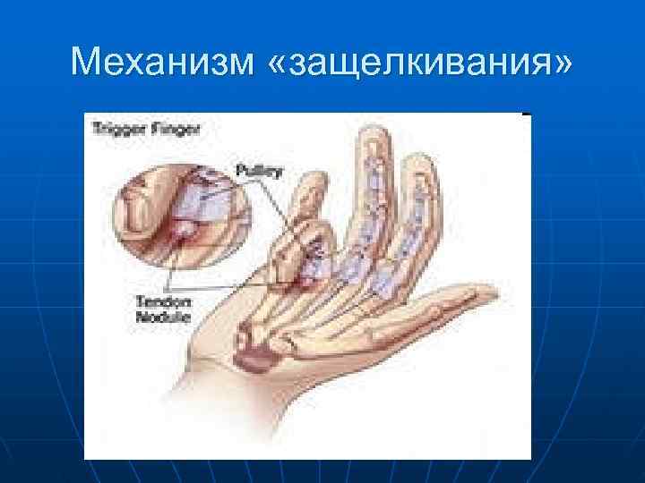 Механизм «защелкивания» 