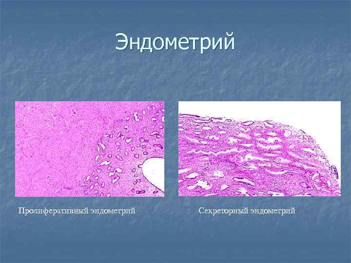      Эндометрий Пролиферативный эндометрий  Секреторный эндометрий 