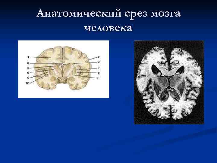 Анатомический срез мозга  человека 