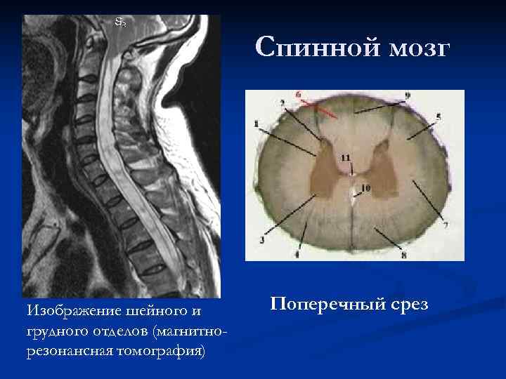      Спинной мозг Изображение шейного и   Поперечный срез