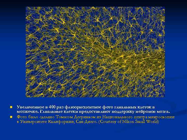 n  Увеличенное в 400 раз флюорисцентное фото глиальных клеток в мозжечке. Глиальные клетки