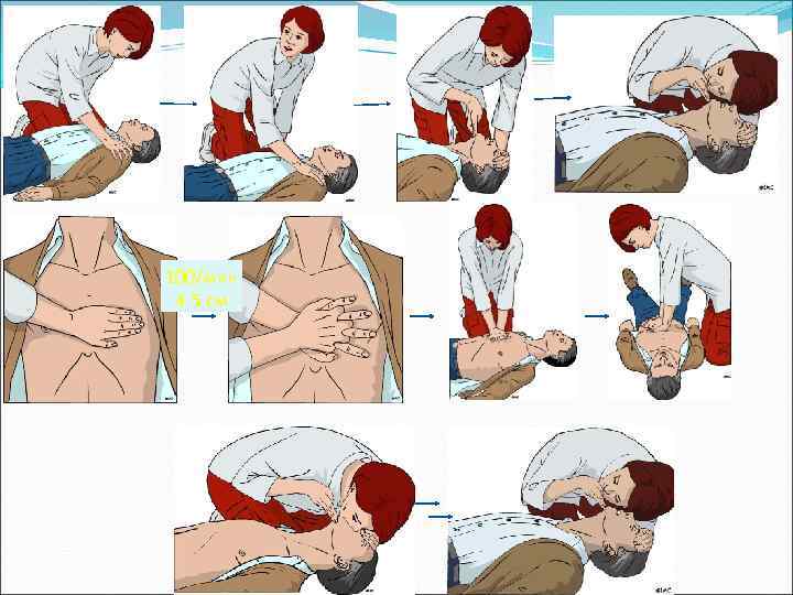 100/мин 4 -5 см 