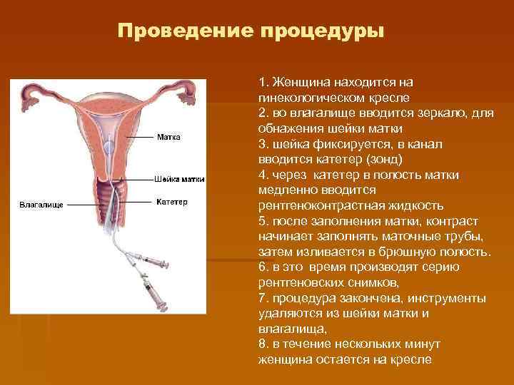 Проведение процедуры  1. Женщина находится на  гинекологическом кресле  2. во влагалище