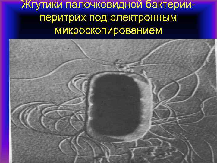 Жгутики палочковидной бактерии-  перитрих под электронным  микроскопированием 