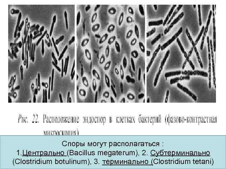  • Р    Споры могут располагаться :  1. Центрально (Bacillus