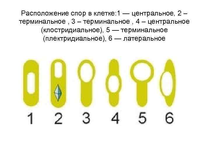  Расположение спор в клетке: 1 — центральное, 2 – терминальное , 3 –
