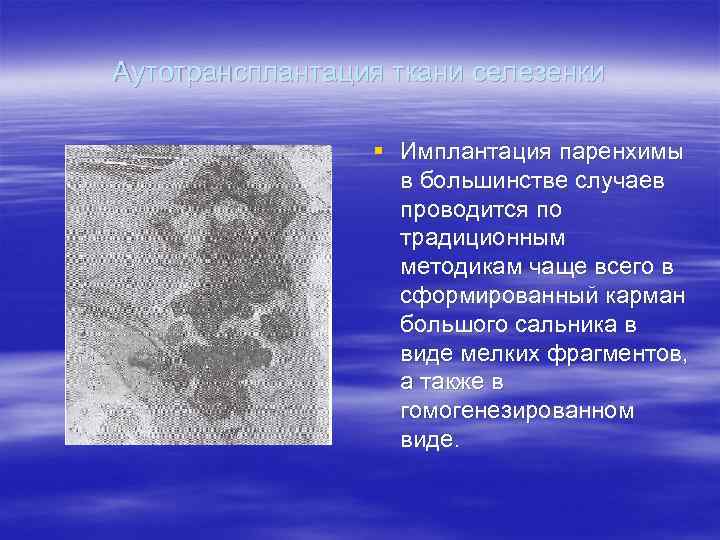 Аутотрансплантация ткани селезенки    § Имплантация паренхимы    в большинстве