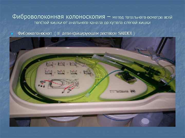 Фиброволоконная колоноскопия – метод тотального осмотра всей  толстой кишки от анального канала до