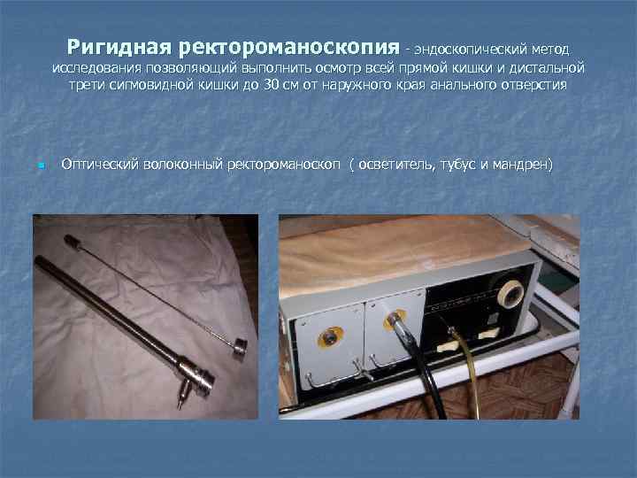  Ригидная ректороманоскопия - эндоскопический метод исследования позволяющий выполнить осмотр всей прямой кишки и
