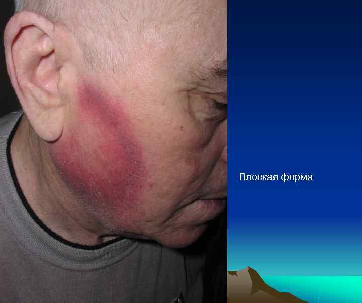 Плоская форма 