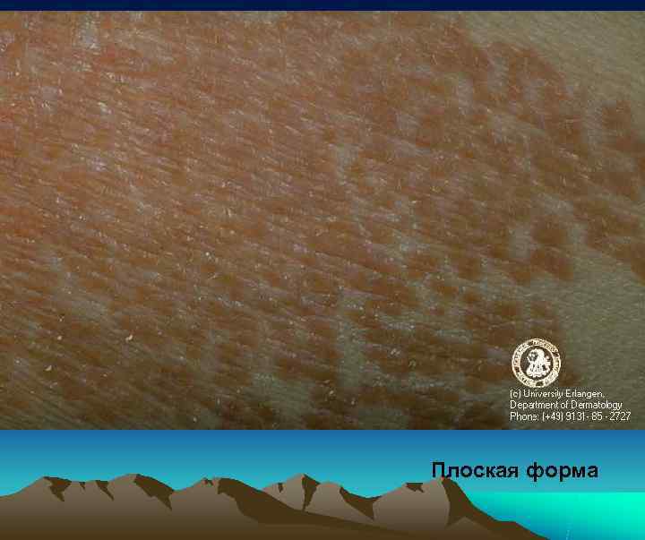 Плоская форма 