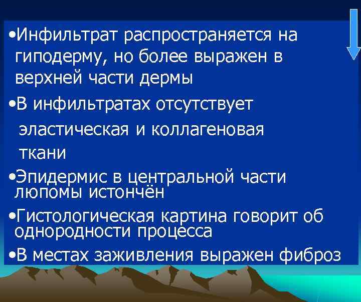  • Инфильтрат распространяется на гиподерму, но более выражен в верхней части дермы •