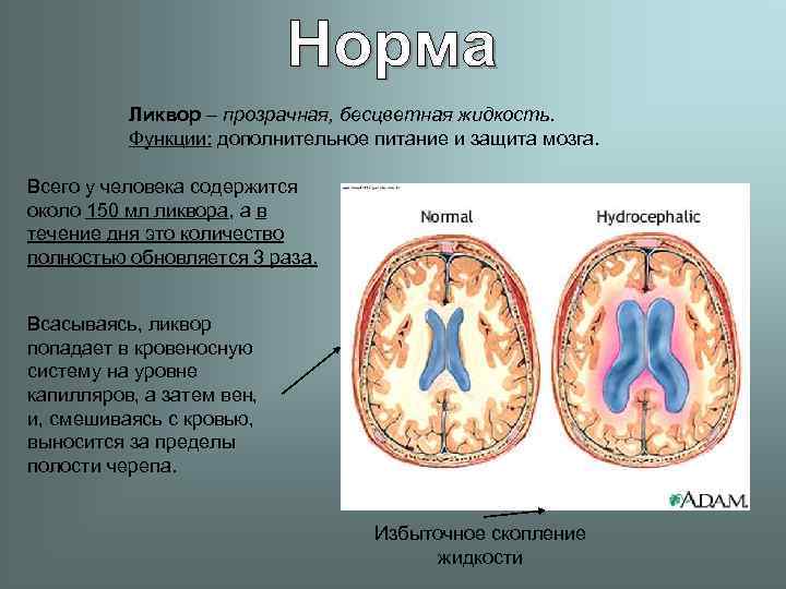    Ликвор – прозрачная, бесцветная жидкость.  Функции: дополнительное питание и защита