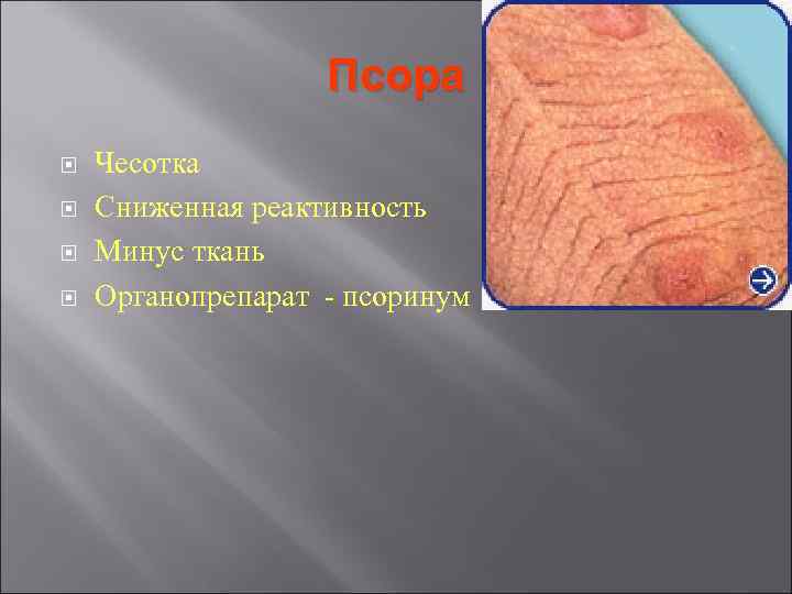 Псора Чесотка Сниженная реактивность Минус ткань Органопрепарат - псоринум Псора Чесотка Сниженная реактивность Минус ткань Органопрепарат - псоринум