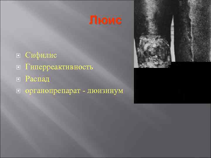 Люис Сифилис Гиперреактивность Распад органопрепарат - люизинум Люис Сифилис Гиперреактивность Распад органопрепарат - люизинум