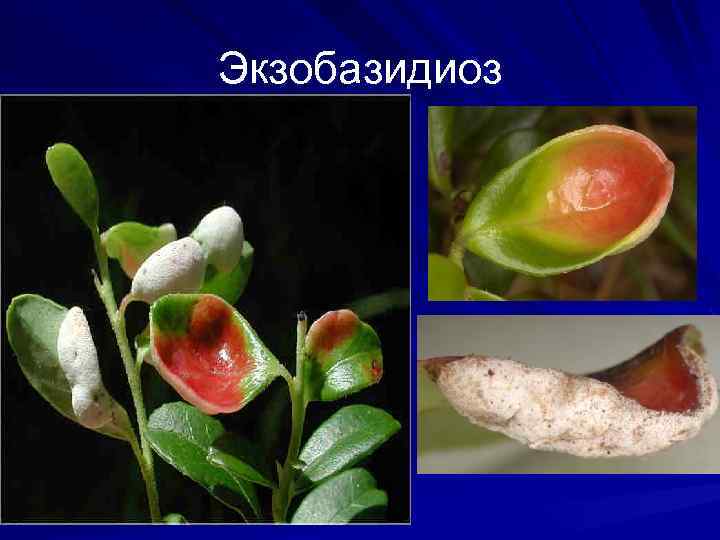 Экзобазидиоз 