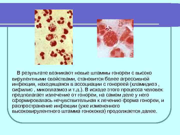 В результате чего возникает. Гонорея симптомы профилактика. Гонорея буклет. Меры предупреждения сифилиса и гонореи.