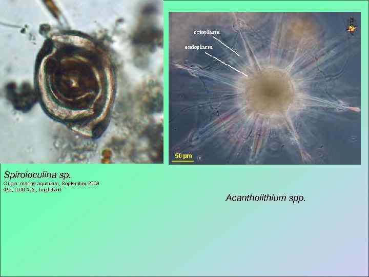 Spiroloculina sp. Origin: marine aquarium, September 2003 45 x, 0. 66 N. A. ,