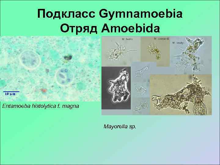    Подкласс Gymnamoebia   Отряд Amoebida Entamoeba histolytica f. magna 