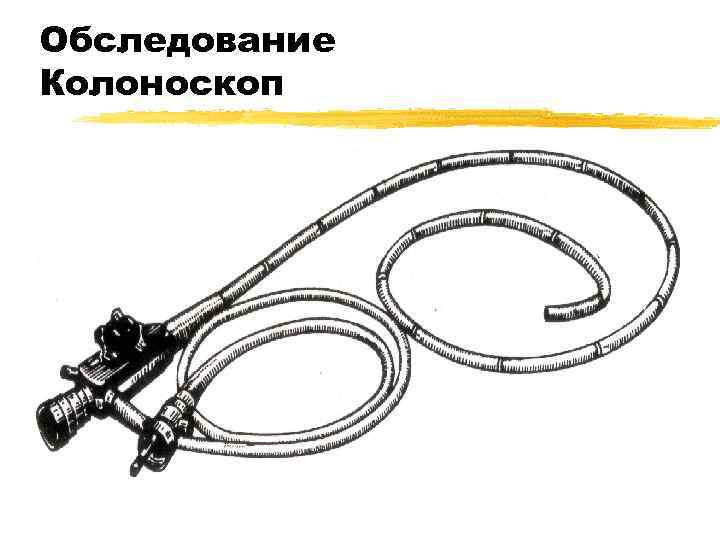 Обследование Колоноскоп 