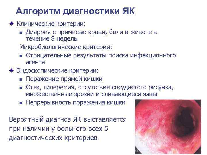  Алгоритм диагностики ЯК  Клинические критерии: n Диаррея с примесью крови, боли в