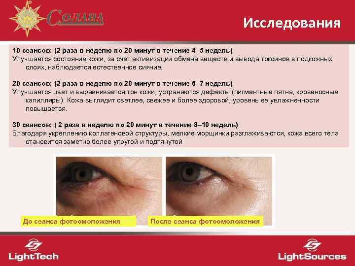       Исследования 10 сеансов: (2 раза в неделю по