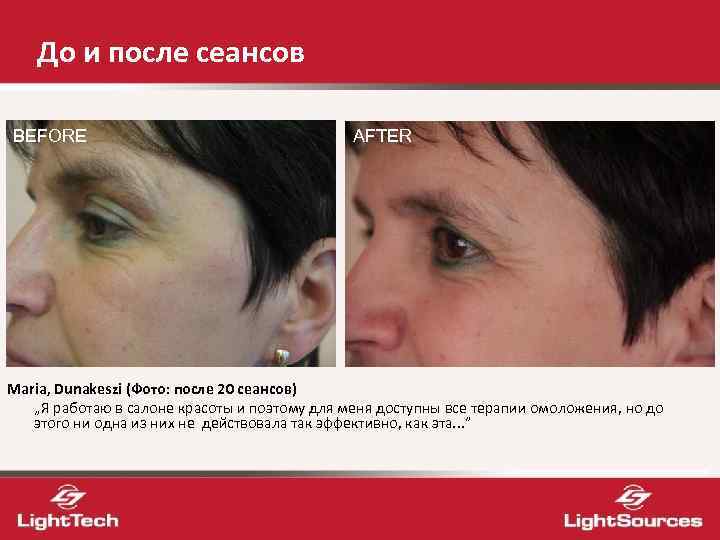   До и после сеансов BEFORE    AFTER Maria, Dunakeszi (Фото: