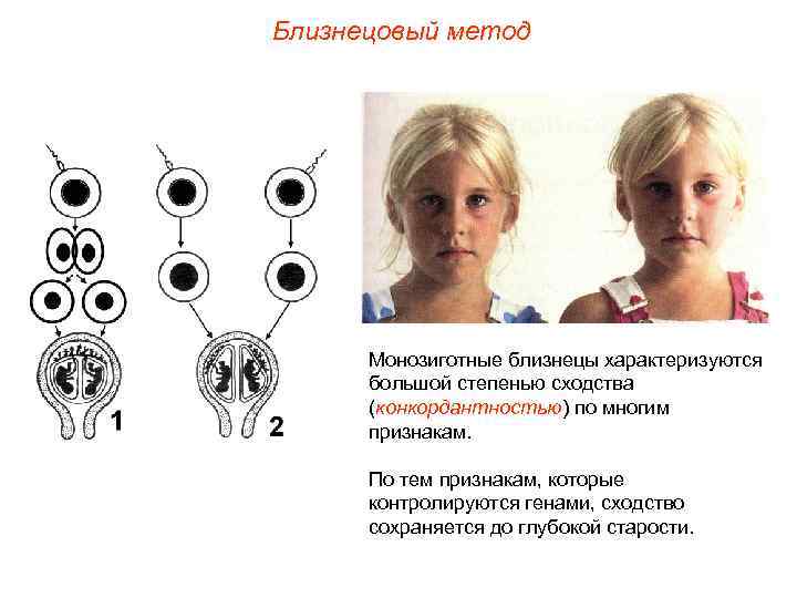 Близнецовый метод  Монозиготные близнецы характеризуются  большой степенью сходства  (конкордантностью) по многим