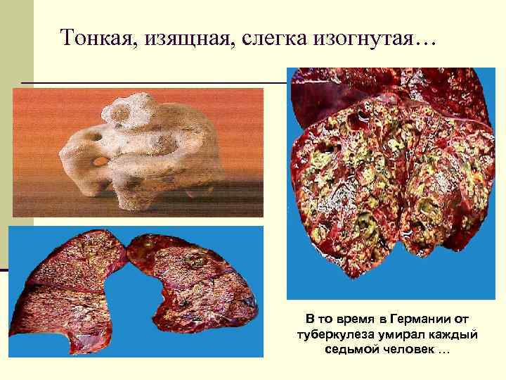 Тонкая, изящная, слегка изогнутая…      В то время в Германии